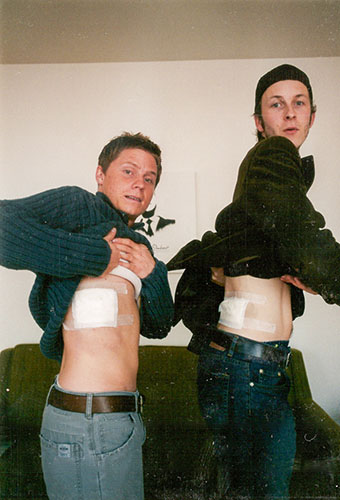 Creators of the Deacdes Project in 2002 with bandage covering new tattoo.